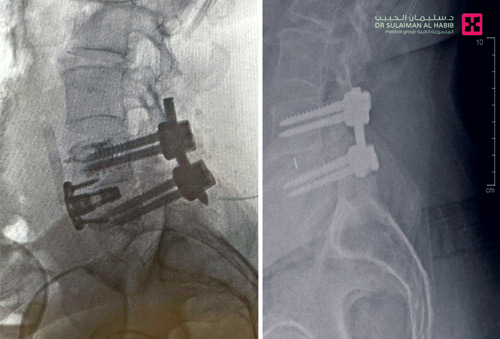 تخلص من آلام غيرت نمط حياته 