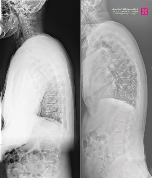 لأول مرة «بالقصيم وشمال المملكة» 