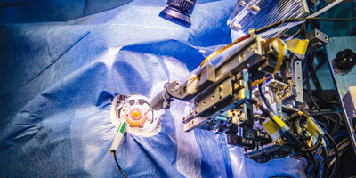 الصين تطوّر روبوتًا لجراحة العين 