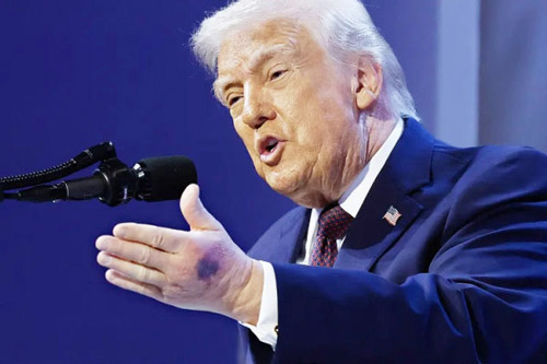 ترمب: كندا تعارض بناء «القبة الذهبية» فوق غرينلاند 