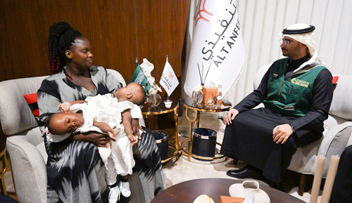  وصول التوأم الملتصق التنزاني (لايتيينس ولوفنس)