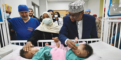 فصل التوأم الملتصق الصومالي «رحمة ورملا» 