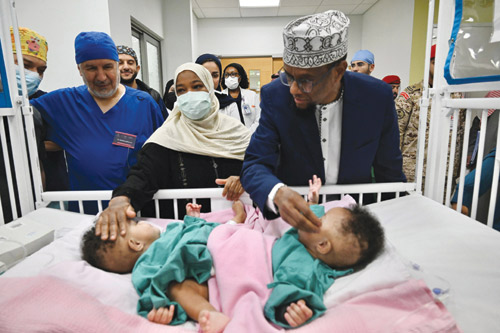 فصل التوأم الملتصق الصومالي «رحمة ورملا» 